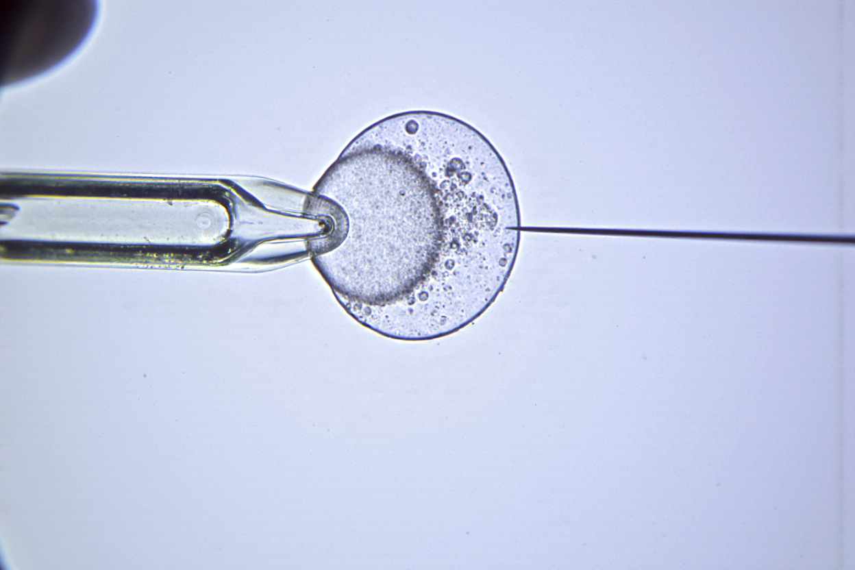 Understanding Your Fertility Treatment Options